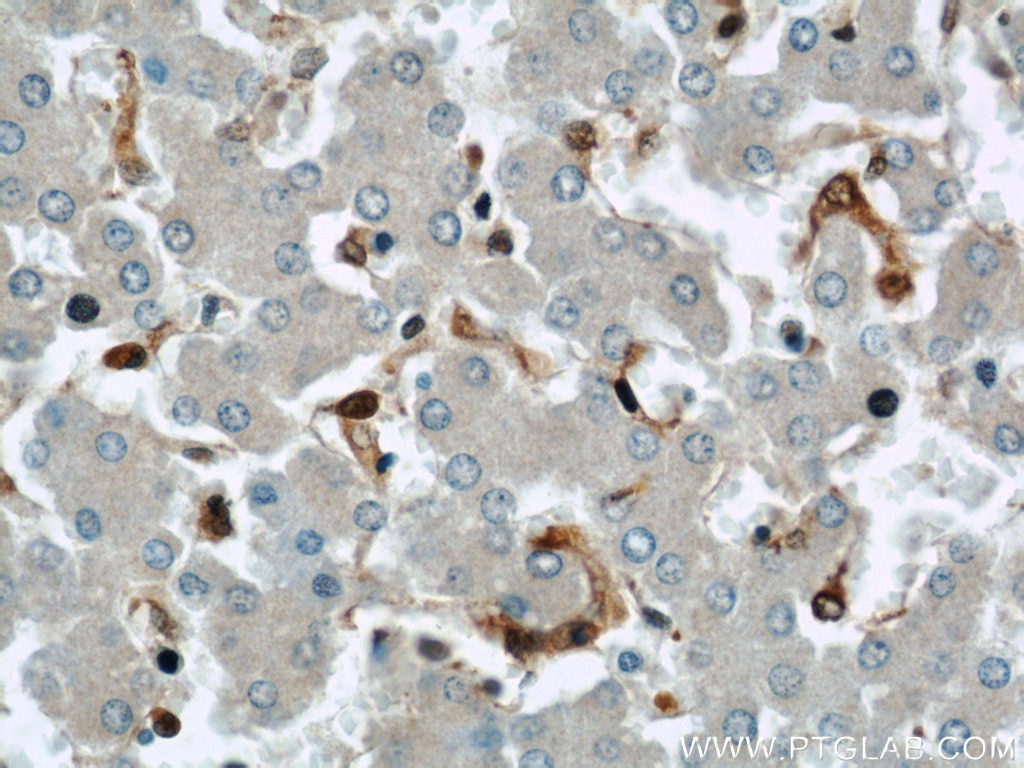Immunohistochemistry (IHC) staining of human liver tissue using GSTP1 Polyclonal antibody (15902-1-AP)