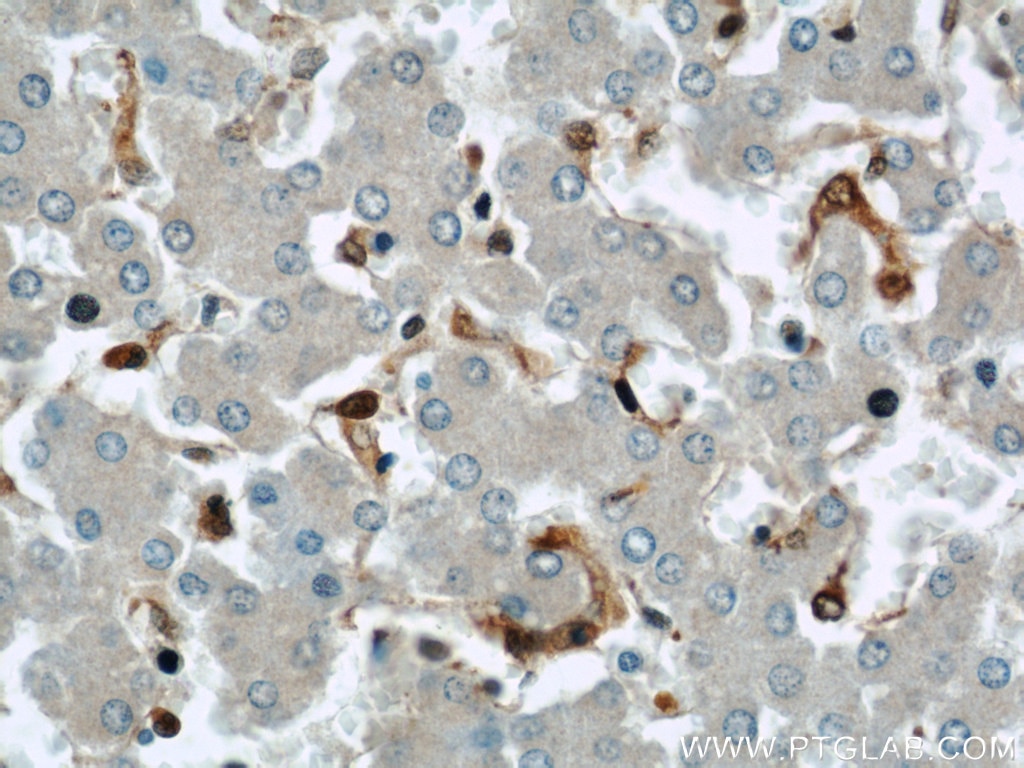 IHC staining of human liver using 15902-1-AP