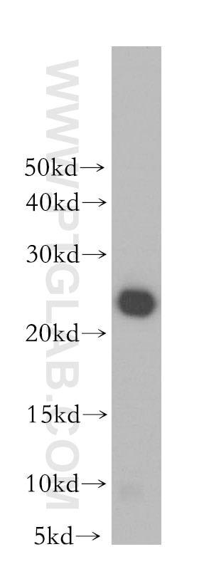 Western Blot (WB) analysis of human brain tissue using GSTP1 Polyclonal antibody (15902-1-AP)