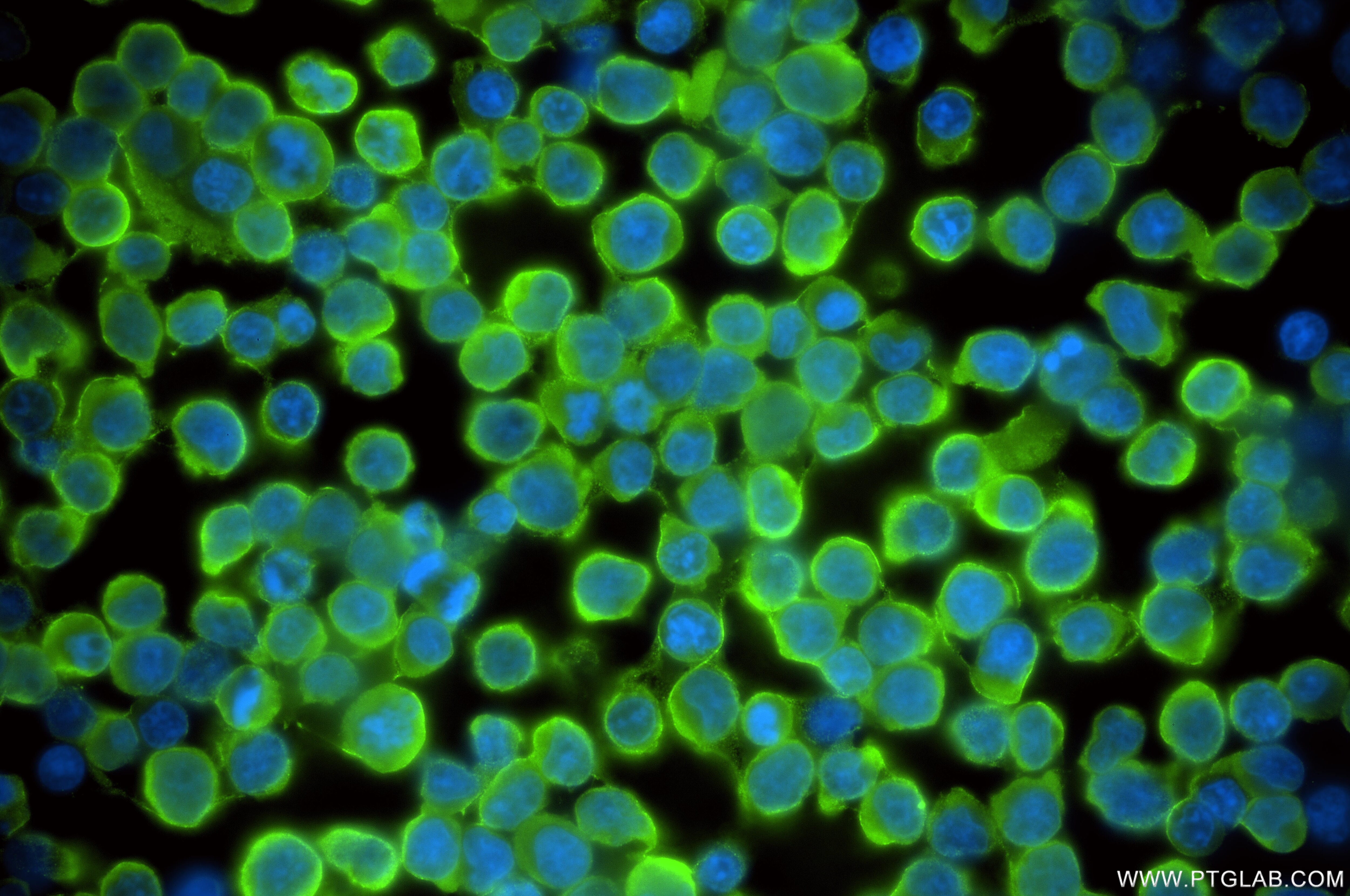 IF Staining of Jurkat using 86708-1-RR Immunofluorescence (IF) / fluorescent staining of Jurkat cells using GSTP1 Recombinant monoclonal antibody (86708-1-RR)