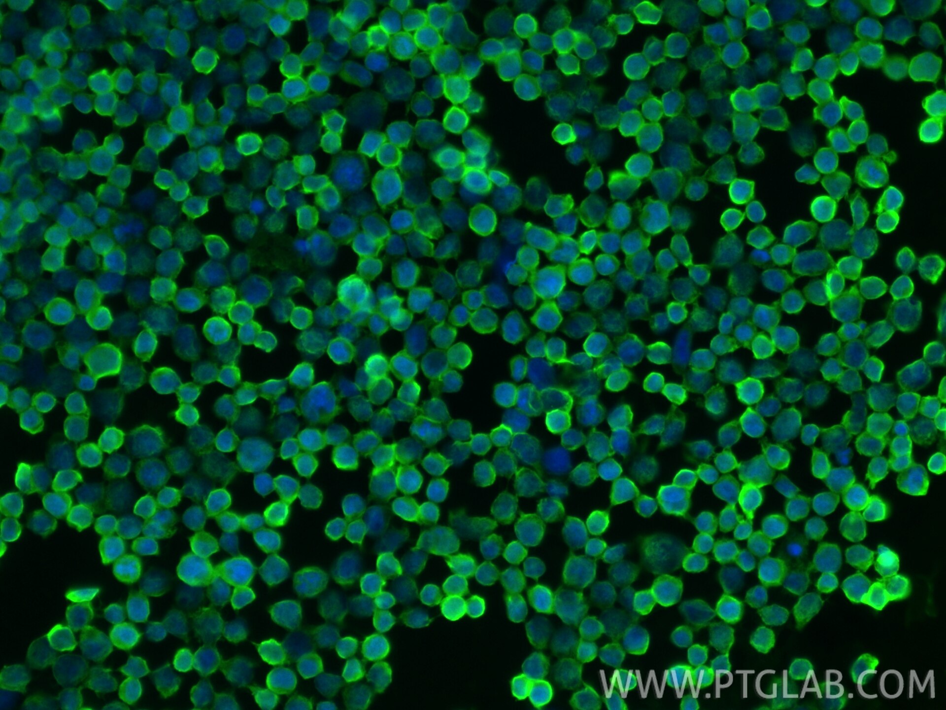 IF Staining of Jurkat using RMX00121 Immunofluorescence (IF) / fluorescent staining of Jurkat cells using Multi-rAb® GSTP1 Multi-Recombinant antibody (RMX00121)