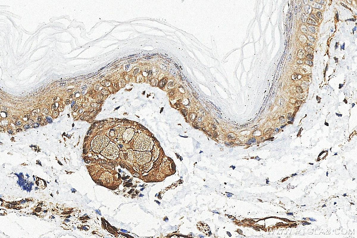 IHC staining of mouse skin using RMX00121 Immunohistochemistry (IHC) staining of mouse skin tissue using Multi-rAb® GSTP1 Multi-Recombinant antibody (RMX00121)
