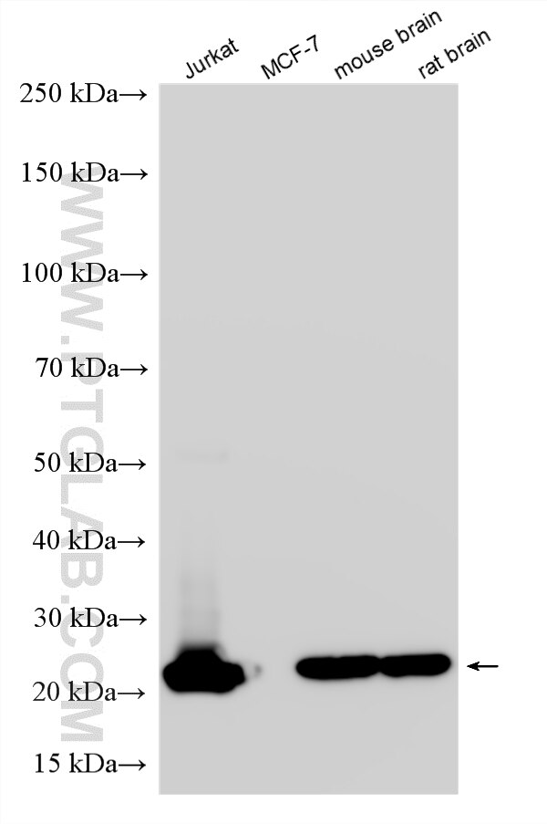 WB analysis using RMX00121 Western Blot (WB) analysis of various lysates using Multi-rAb® GSTP1 Multi-Recombinant antibody (RMX00121)