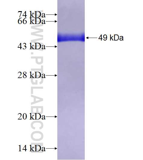 GSTP1 fusion protein Ag8731 SDS-PAGE