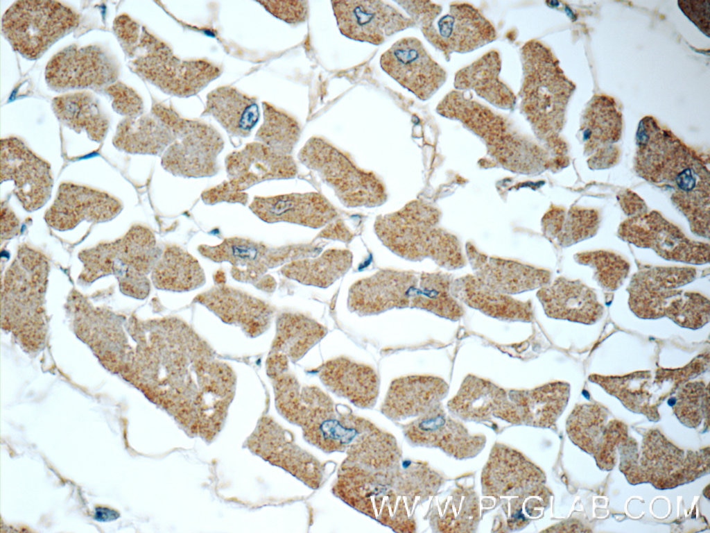 Immunohistochemistry (IHC) staining of human heart tissue using GSTT1 Polyclonal antibody (15838-1-AP)