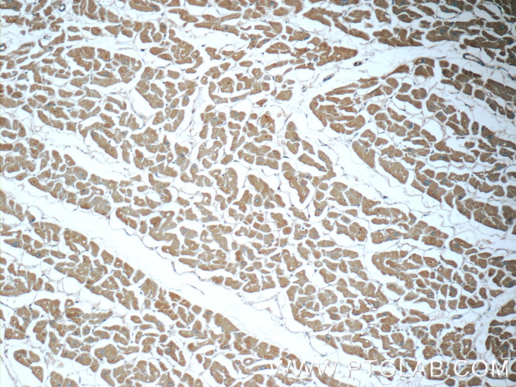 Immunohistochemistry (IHC) staining of human heart tissue using GSTT1 Polyclonal antibody (15838-1-AP)