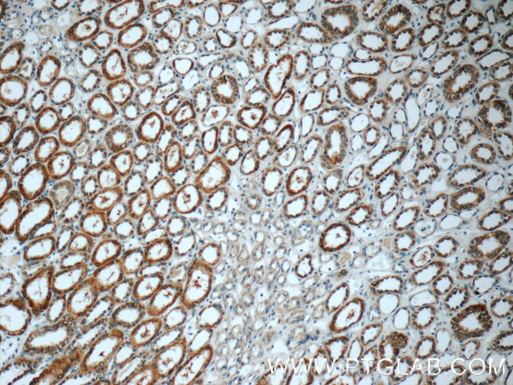 Immunohistochemistry (IHC) staining of human kidney tissue using GSTT1 Polyclonal antibody (15838-1-AP)