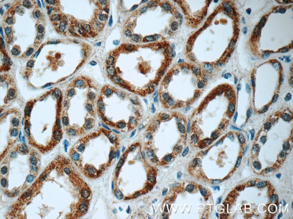 Immunohistochemistry (IHC) staining of human kidney tissue using GSTT1 Polyclonal antibody (15838-1-AP)