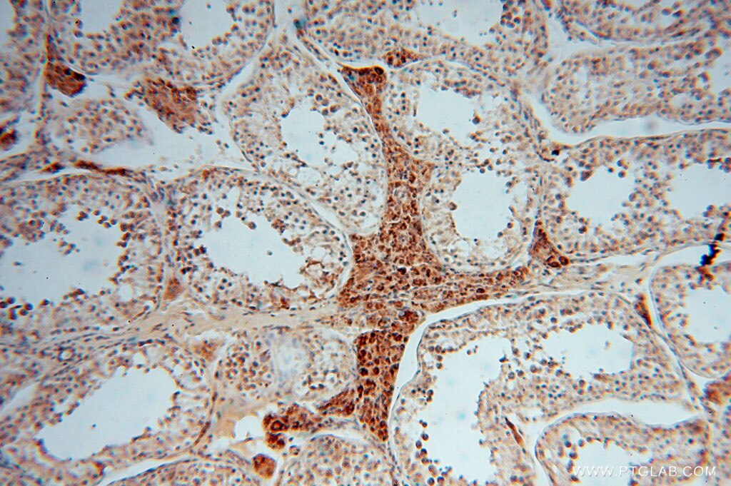 IHC staining of human testis using 15838-1-AP