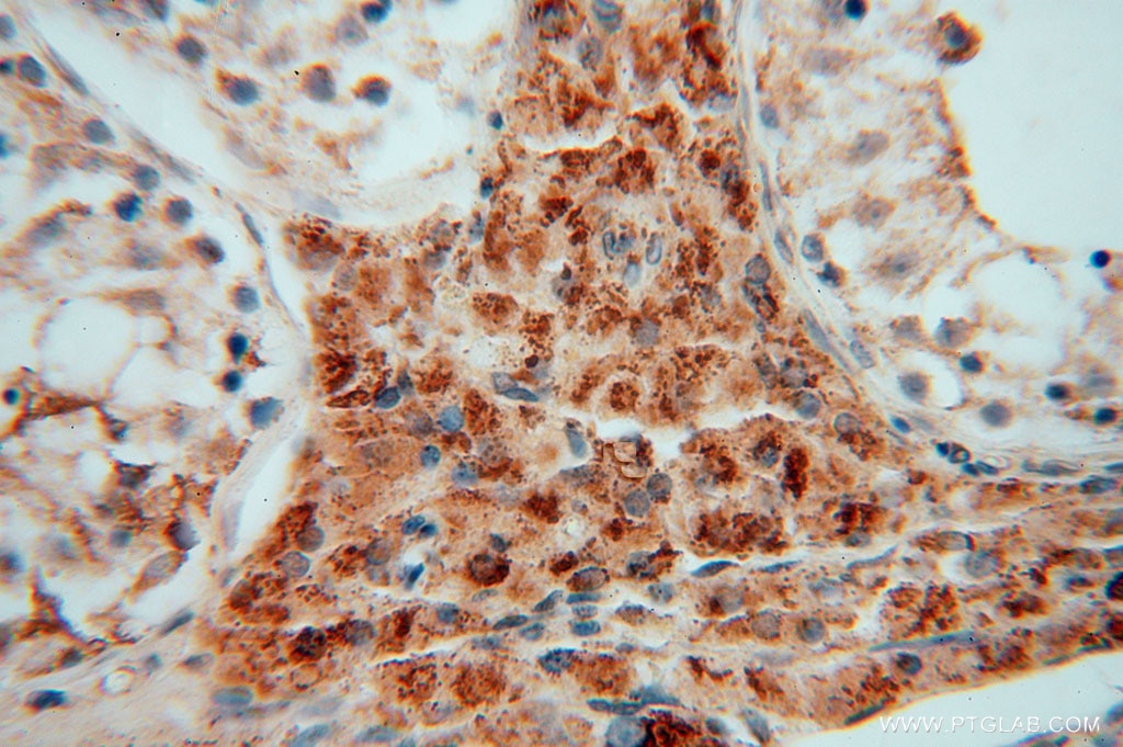 Immunohistochemistry (IHC) staining of human testis tissue using GSTT1 Polyclonal antibody (15838-1-AP)