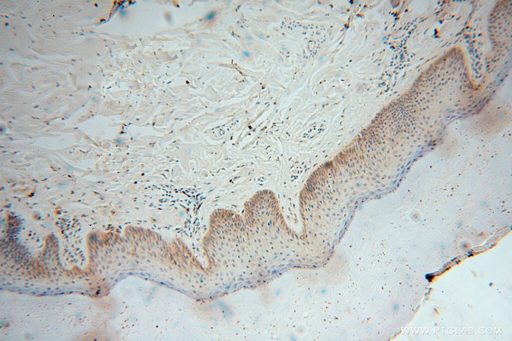 Immunohistochemistry (IHC) staining of human skin tissue using GSTT1 Polyclonal antibody (15838-1-AP)