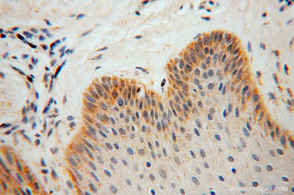 Immunohistochemistry (IHC) staining of human skin tissue using GSTT1 Polyclonal antibody (15838-1-AP)