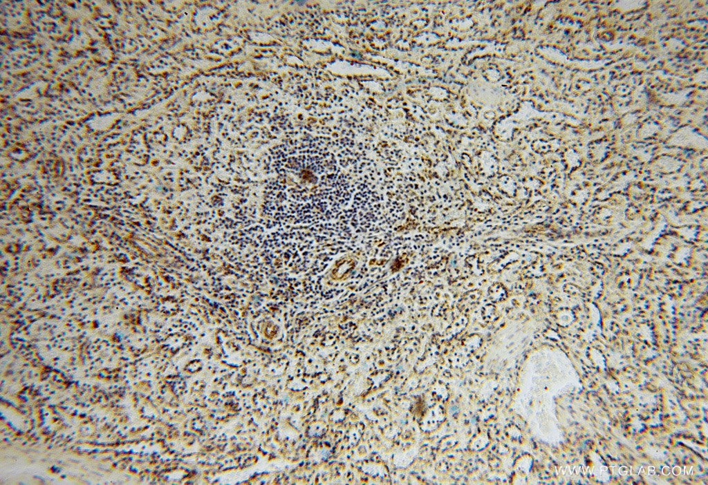 IHC staining of human spleen using 15838-1-AP