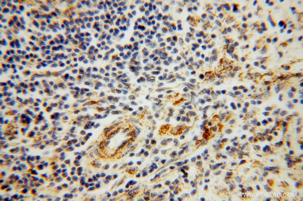 Immunohistochemistry (IHC) staining of human spleen tissue using GSTT1 Polyclonal antibody (15838-1-AP)