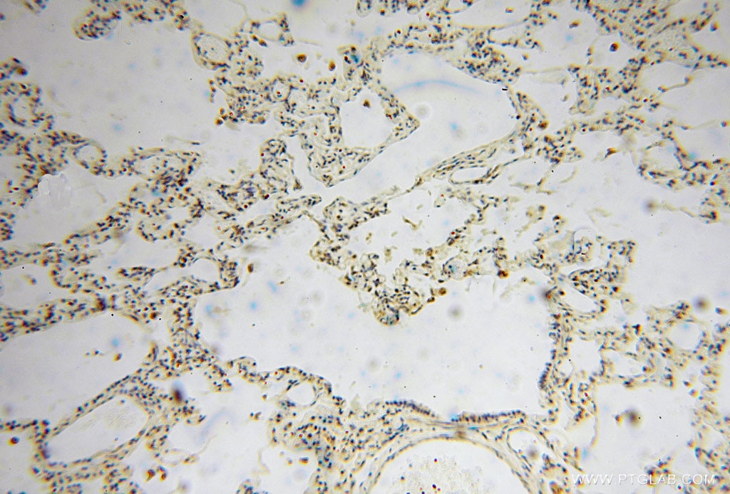 Immunohistochemistry (IHC) staining of human lung tissue using GSTT1 Polyclonal antibody (15838-1-AP)