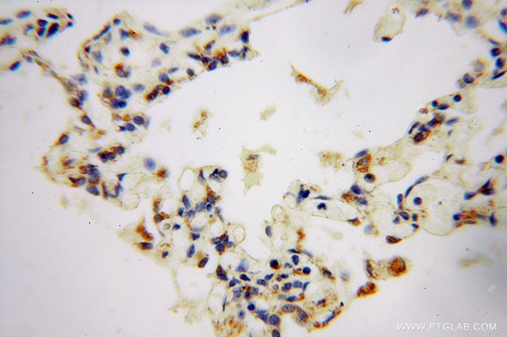 Immunohistochemistry (IHC) staining of human lung tissue using GSTT1 Polyclonal antibody (15838-1-AP)