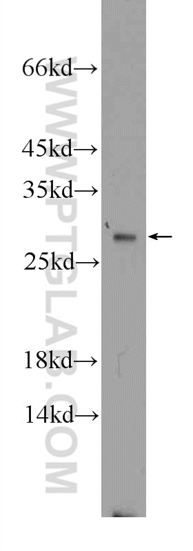 Western Blot (WB) analysis of mouse brain tissue using GSTT1 Polyclonal antibody (15838-1-AP)
