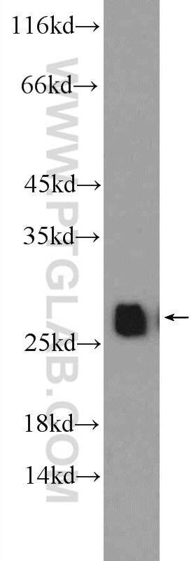 Western Blot (WB) analysis of mouse liver tissue using GSTT1 Polyclonal antibody (15838-1-AP)