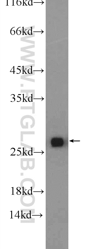 Western Blot (WB) analysis of rat liver tissue using GSTT1 Polyclonal antibody (15838-1-AP)