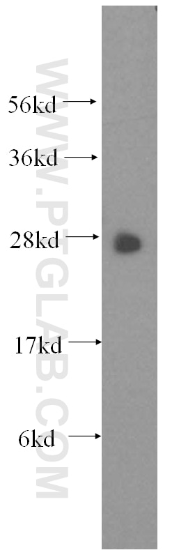 Western Blot (WB) analysis of human brain tissue using GSTT1 Polyclonal antibody (15838-1-AP)