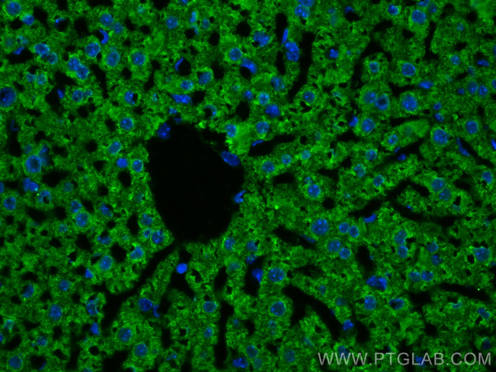 Immunofluorescence (IF) / fluorescent staining of mouse liver tissue using GSTT1 Monoclonal antibody (67645-1-Ig)