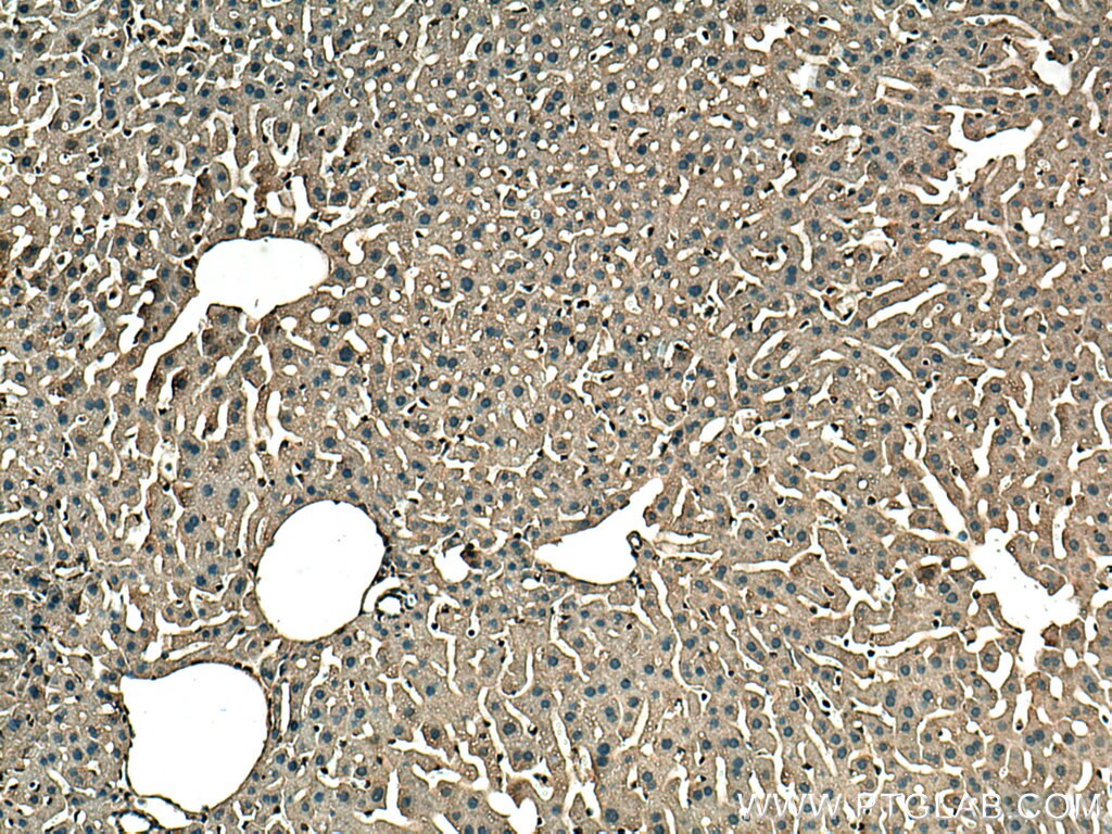 Immunohistochemistry (IHC) staining of mouse liver tissue using GSTT1 Monoclonal antibody (67645-1-Ig)
