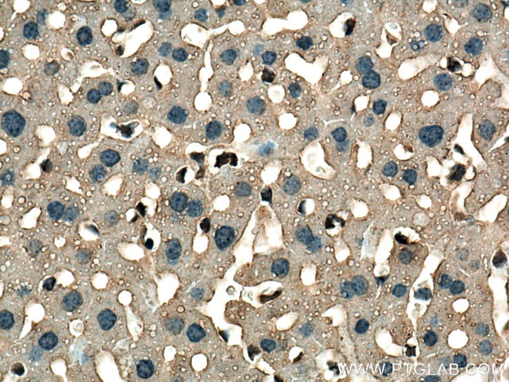 Immunohistochemistry (IHC) staining of mouse liver tissue using GSTT1 Monoclonal antibody (67645-1-Ig)