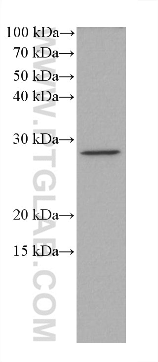 WB analysis of K-562 using 67645-1-Ig