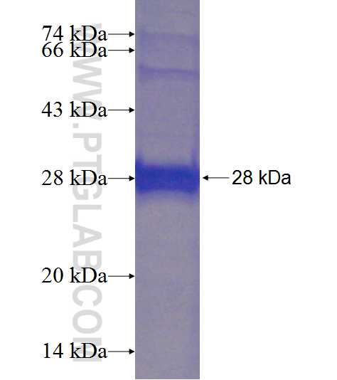 GSTT1 fusion protein Ag8573 SDS-PAGE