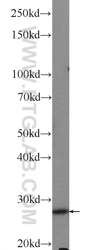 WB analysis of mouse lung using 15063-1-AP