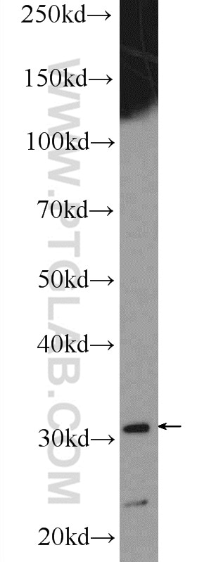 WB analysis of L02 using 15063-1-AP