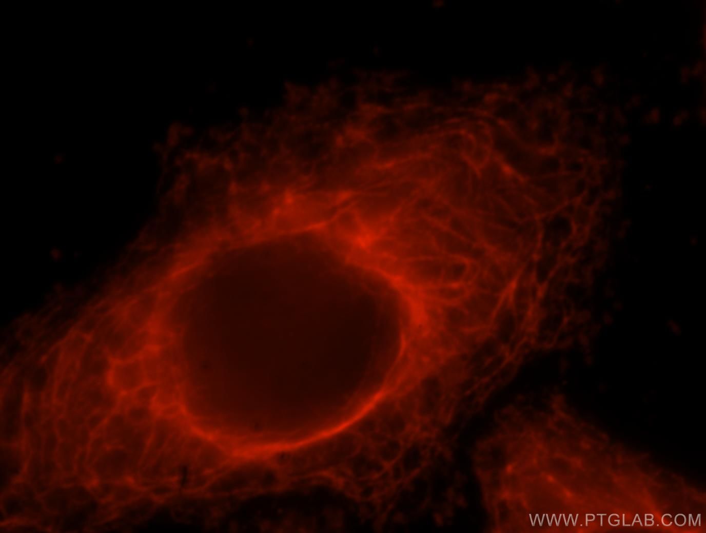 Immunofluorescence (IF) / fluorescent staining of HepG2 cells using GSTT2B Polyclonal antibody (17622-1-AP)