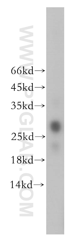 Western Blot (WB) analysis of human liver tissue using GSTT2B Polyclonal antibody (17622-1-AP)
