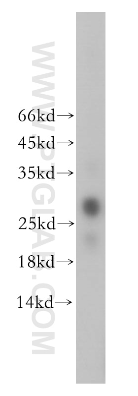 WB analysis of human liver using 17622-1-AP