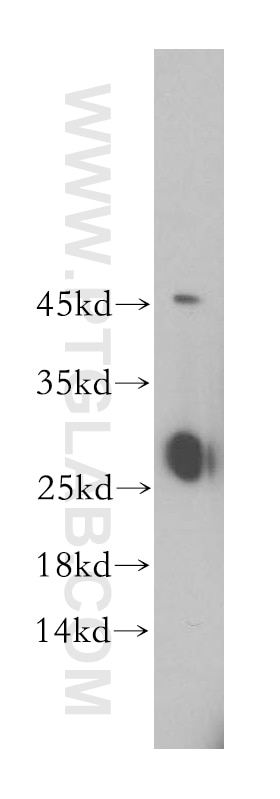 Western Blot (WB) analysis of human brain tissue using GSTT2B Polyclonal antibody (17622-1-AP)