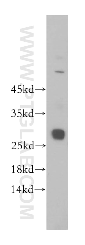 Western Blot (WB) analysis of HepG2 cells using GSTT2B Polyclonal antibody (17622-1-AP)