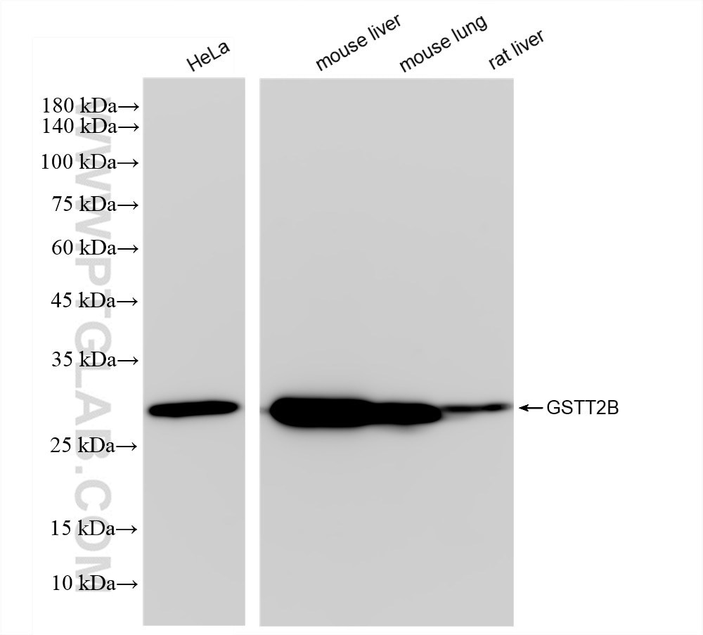 Western Blot (WB) analysis of various lysates using GSTT2B Recombinant antibody (83469-4-RR)