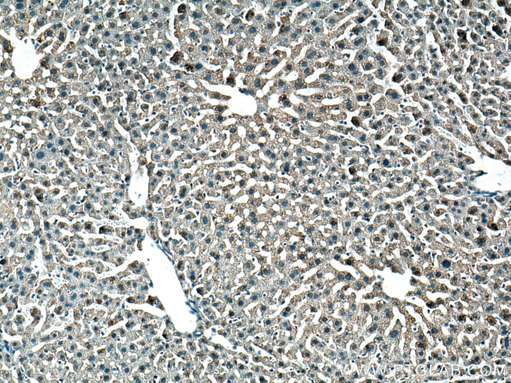 Immunohistochemistry (IHC) staining of mouse liver tissue using GSTZ1 Polyclonal antibody (14889-1-AP)