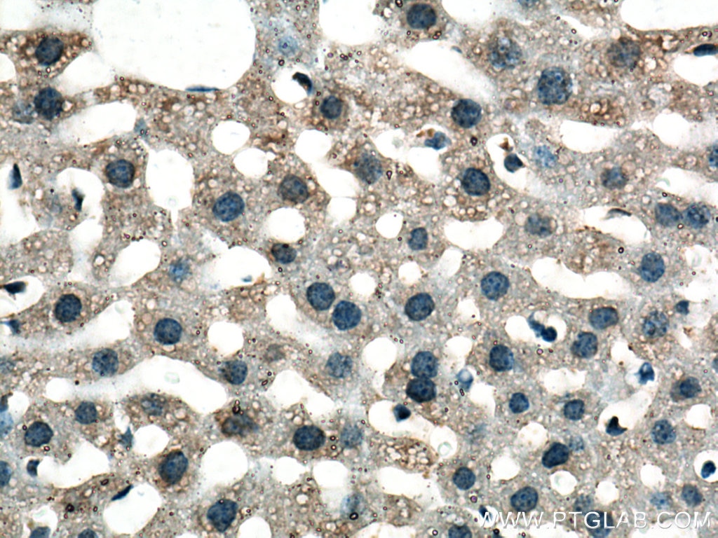 Immunohistochemistry (IHC) staining of mouse liver tissue using GSTZ1 Polyclonal antibody (14889-1-AP)