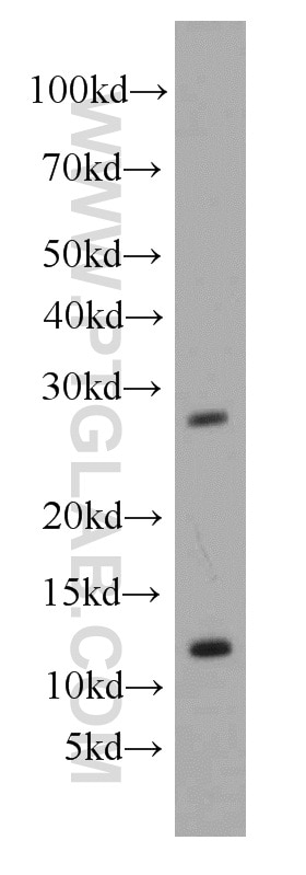 Western Blot (WB) analysis of mouse liver tissue using GSX1 Polyclonal antibody (55050-1-AP)
