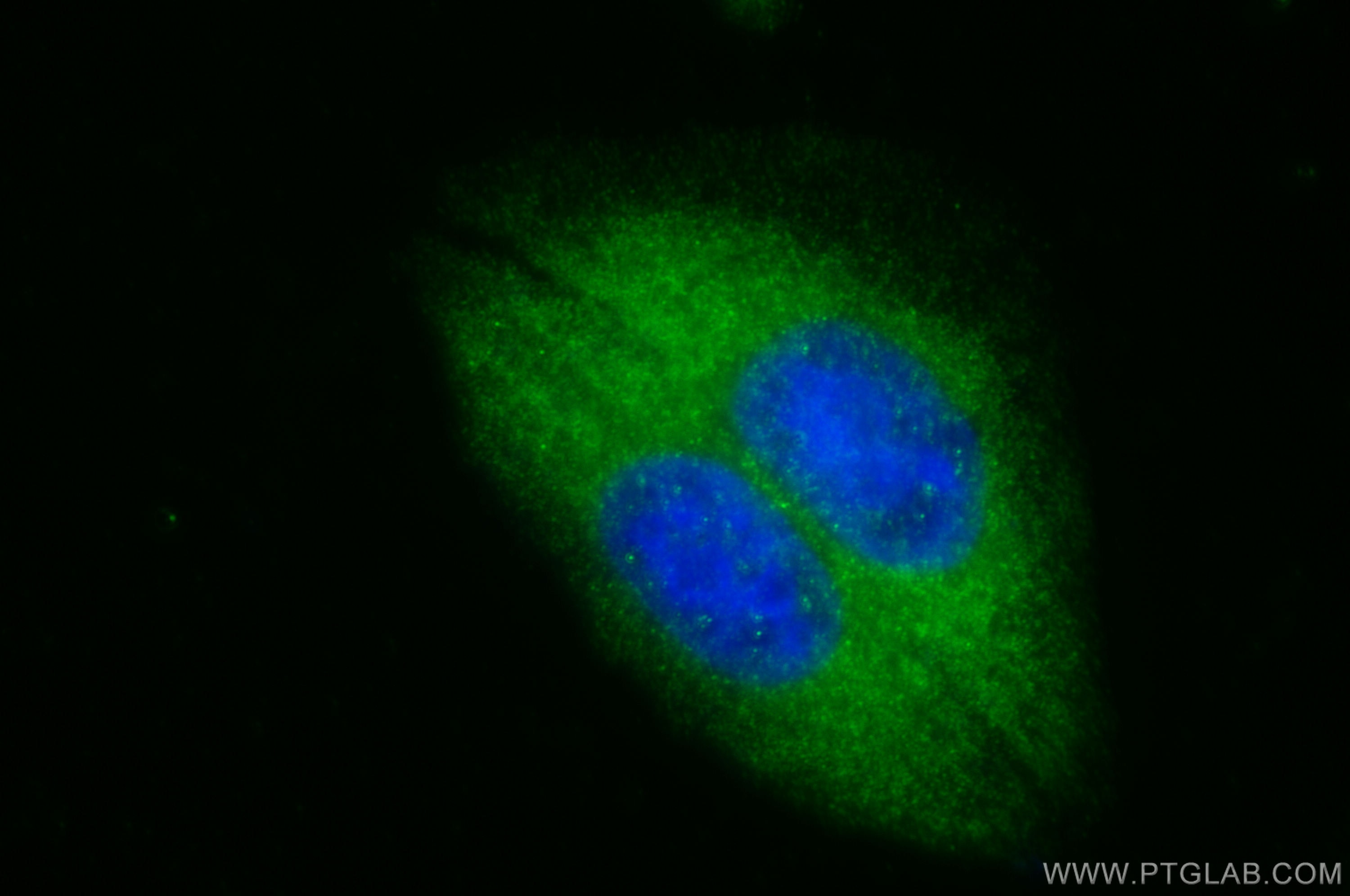 Immunofluorescence (IF) / fluorescent staining of HepG2 cells using GTDC1 Polyclonal antibody (16666-1-AP)