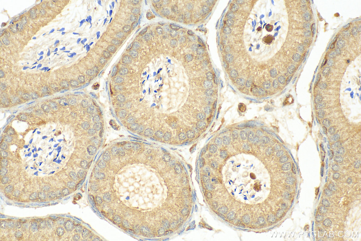 Immunohistochemistry (IHC) staining of mouse testis tissue using GTDC1 Polyclonal antibody (16666-1-AP)