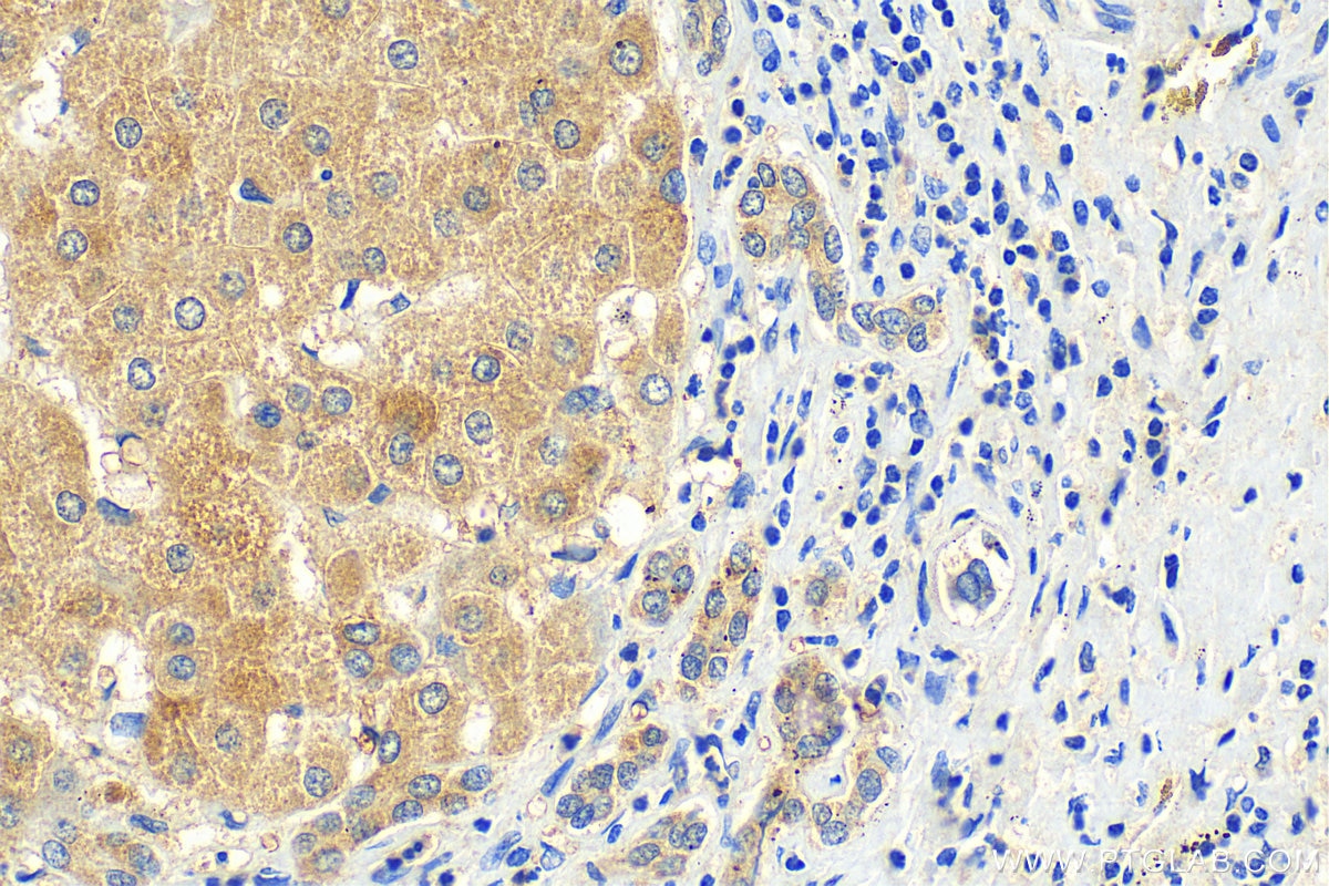 Immunohistochemistry (IHC) staining of human liver tissue using GTDC1 Polyclonal antibody (16666-1-AP)