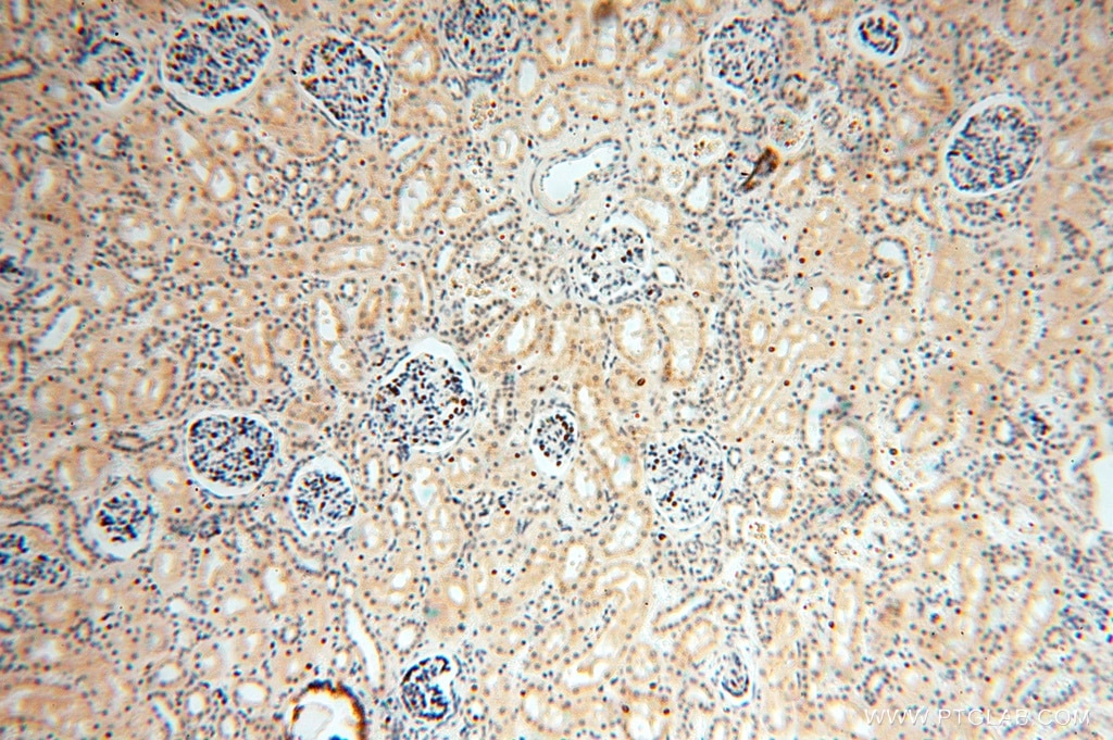 Immunohistochemistry (IHC) staining of human kidney tissue using GTDC1 Polyclonal antibody (16666-1-AP)