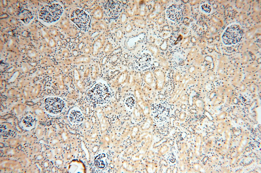 IHC staining of human kidney using 16666-1-AP