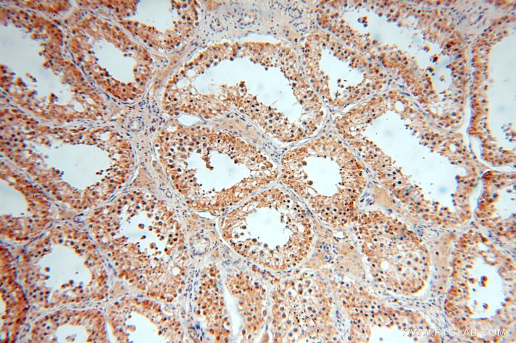 Immunohistochemistry (IHC) staining of human testis tissue using GTDC1 Polyclonal antibody (16666-1-AP)