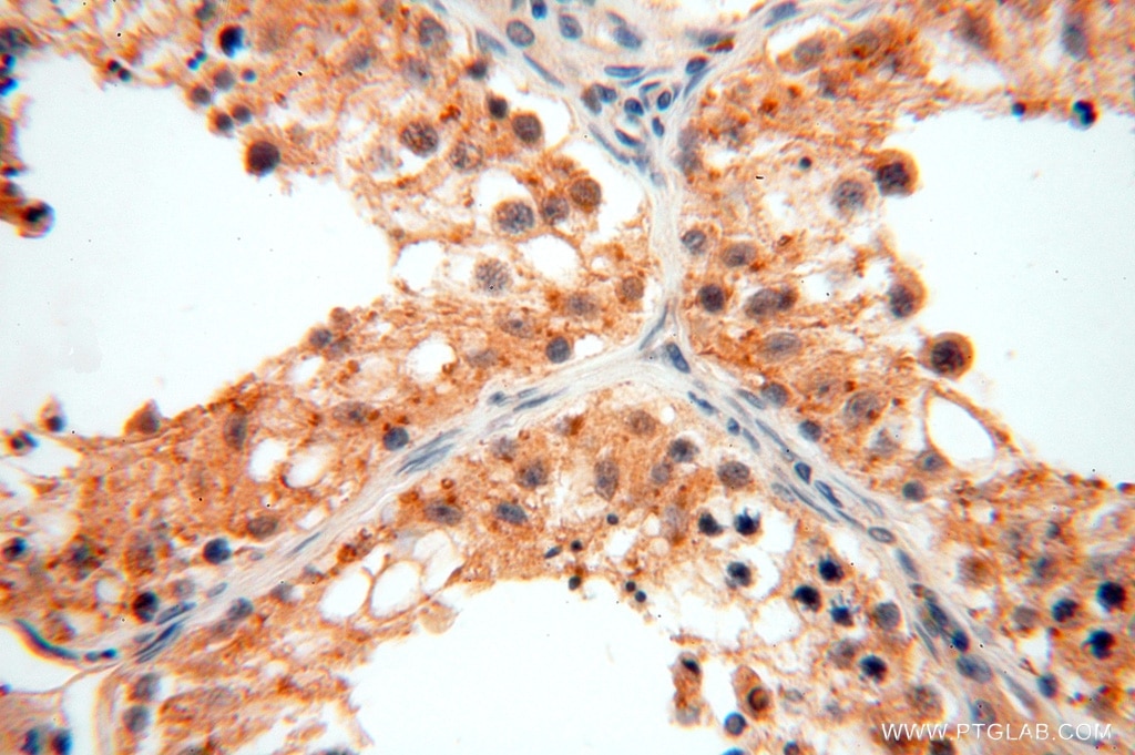Immunohistochemistry (IHC) staining of human testis tissue using GTDC1 Polyclonal antibody (16666-1-AP)