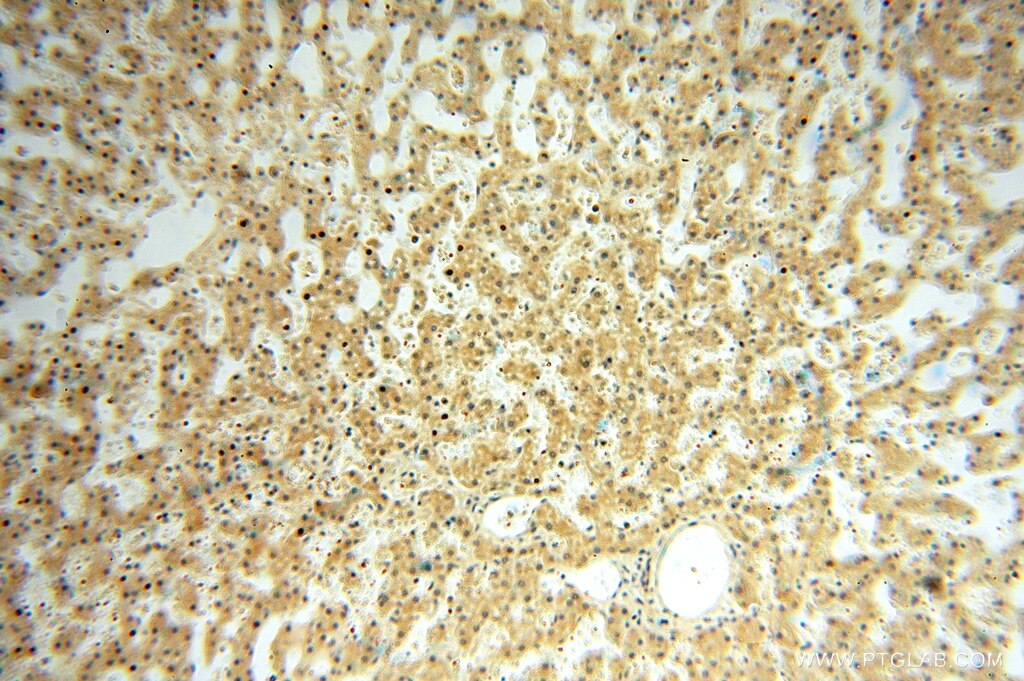 IHC staining of human liver using 16666-1-AP