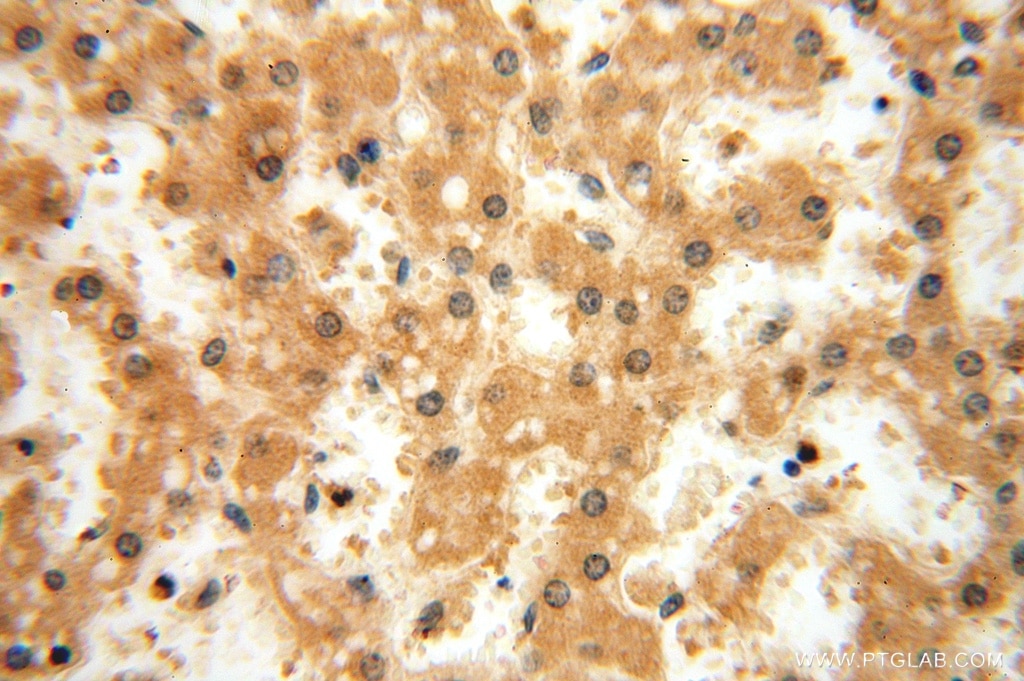 Immunohistochemistry (IHC) staining of human liver tissue using GTDC1 Polyclonal antibody (16666-1-AP)