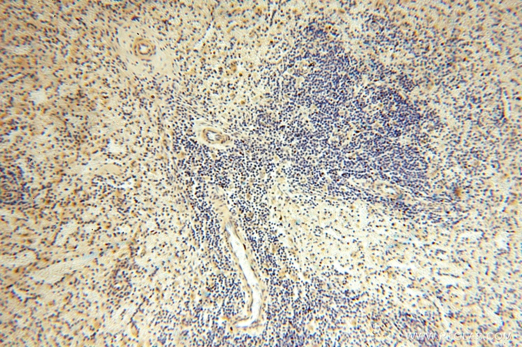 Immunohistochemistry (IHC) staining of human spleen tissue using GTDC1 Polyclonal antibody (16666-1-AP)